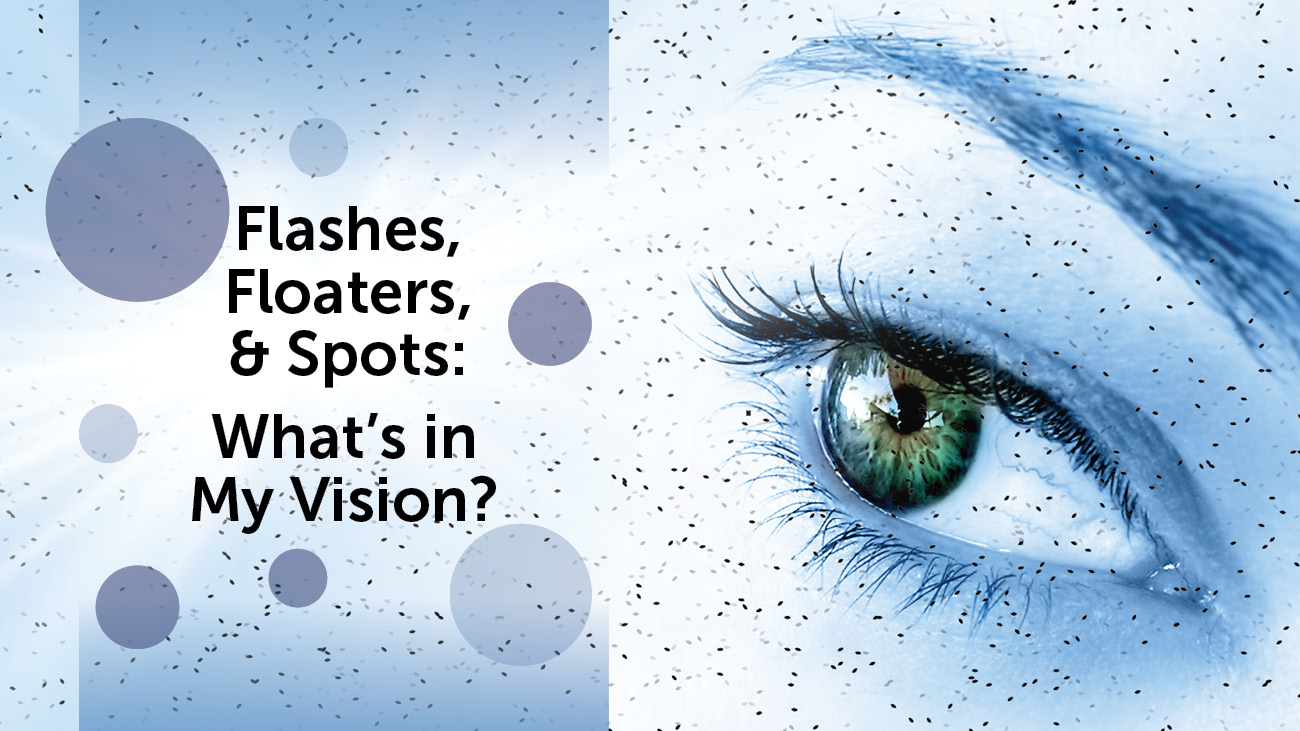 Why You're Seeing Black Spots In Your Vision